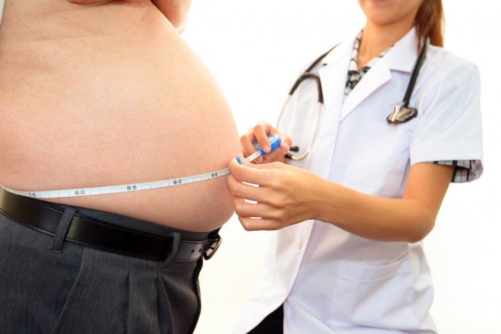Můžu jít na bariatrickou operaci? Můžu jít na bariatrickou operaci?
